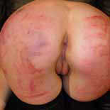 Free Spanking Picture